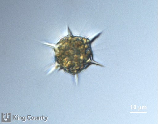 Photo of Dictyocha speculum